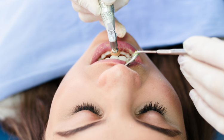 Professionelle Zahnreinigung | Zahnklinik Dreiländereck Rheinfelden